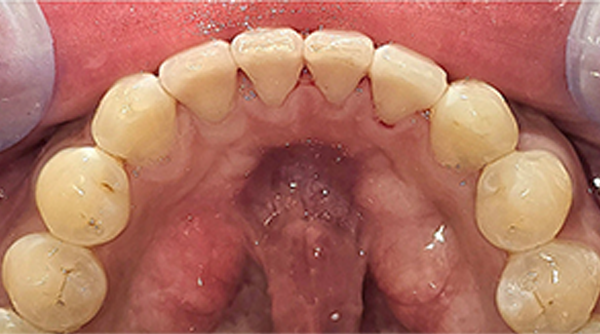 After - The Beresford Dental Clinic