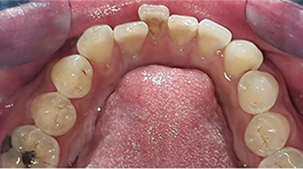 Before - The Beresford Dental Clinic