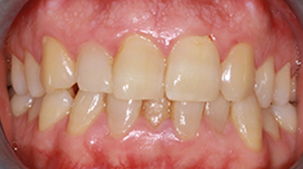 Before - The Beresford Dental Clinic