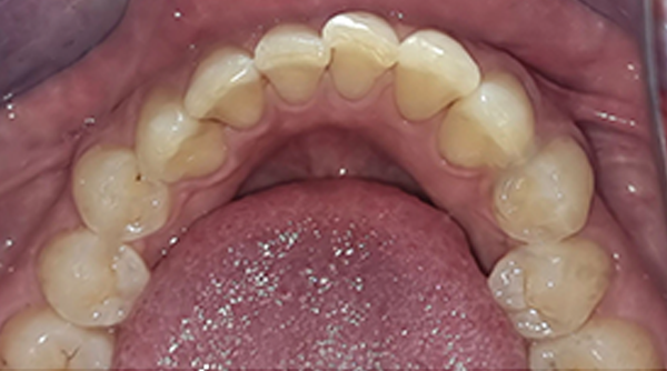 Before - The Beresford Dental Clinic