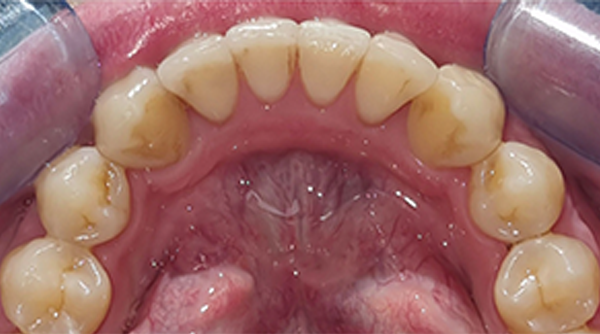 After - The Beresford Dental Clinic