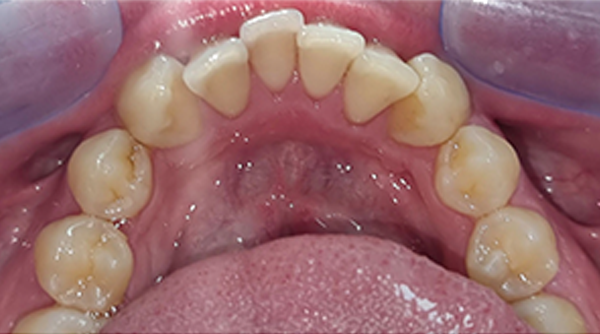 Before - The Beresford Dental Clinic