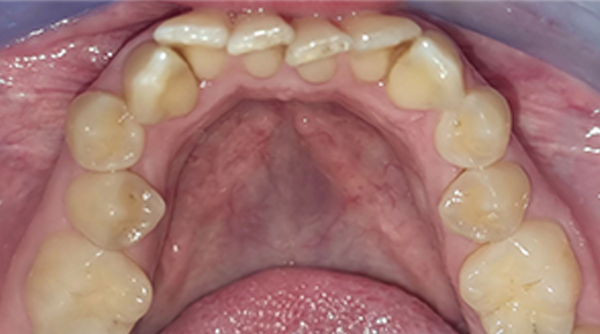 Before - The Beresford Dental Clinic