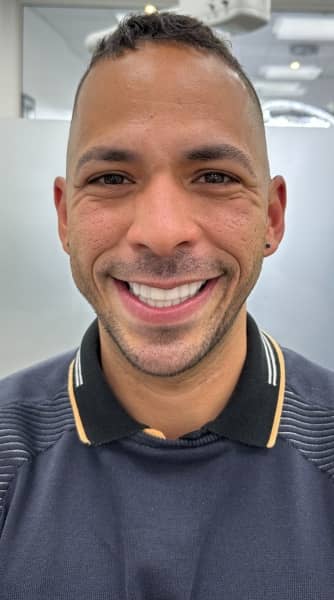 Face After - The Beresford Dental Clinic