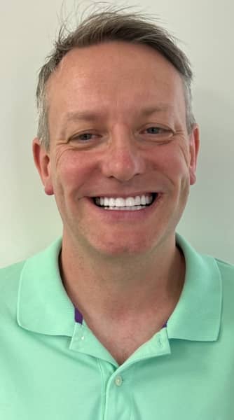 Face After - The Beresford Dental Clinic