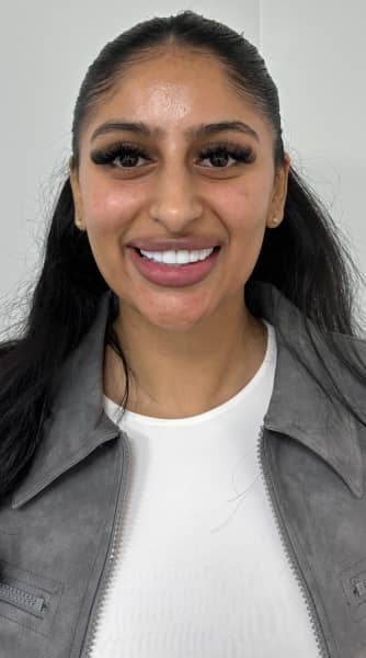 Face After - The Beresford Dental Clinic
