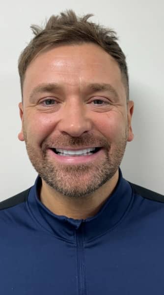 Face After - The Beresford Dental Clinic