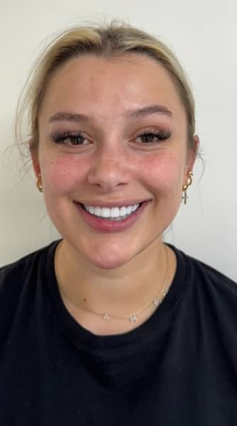 Face After - The Beresford Dental Clinic