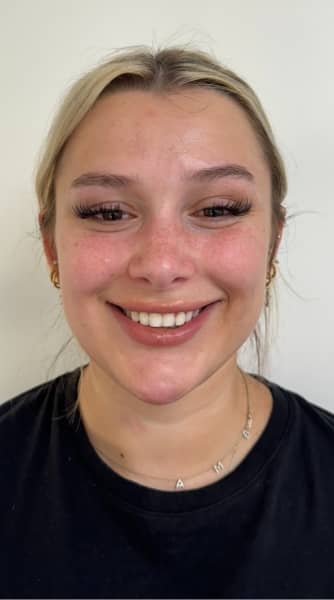 face - The Beresford Dental Clinic