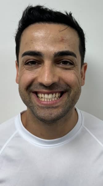 face - The Beresford Dental Clinic