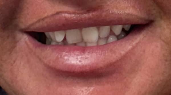 Before - The Beresford Dental Clinic