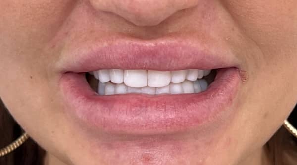 After - The Beresford Dental Clinic