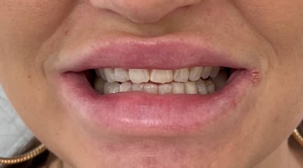Before - The Beresford Dental Clinic