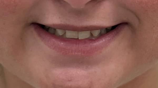 Before - The Beresford Dental Clinic