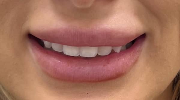 Before - The Beresford Dental Clinic
