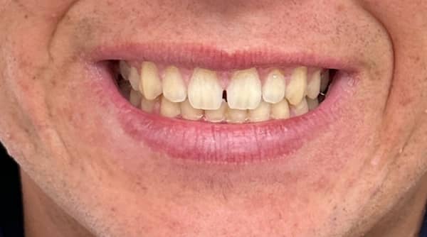 Before - The Beresford Dental Clinic