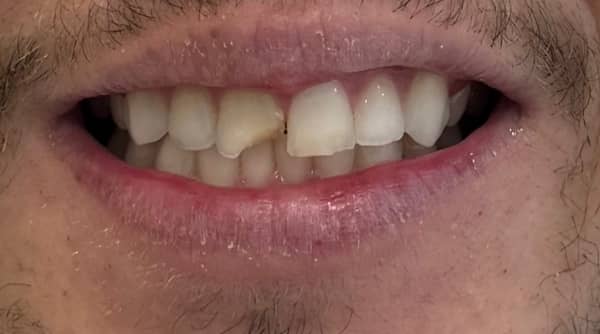 Before - The Beresford Dental Clinic