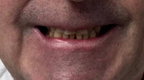 Before - The Beresford Dental Clinic