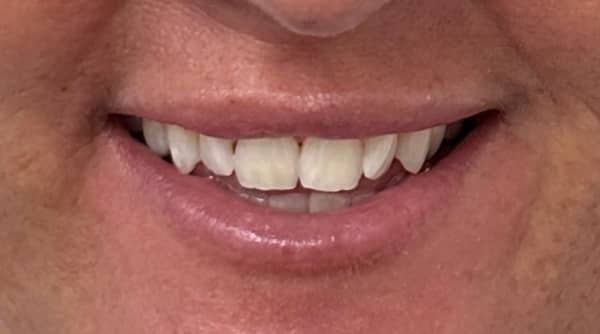 Before - The Beresford Dental Clinic