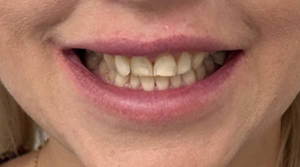 Before - The Beresford Dental Clinic