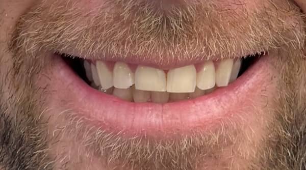 Before - The Beresford Dental Clinic