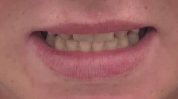 Before - The Beresford Dental Clinic