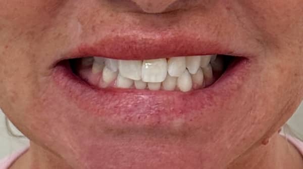 Before - The Beresford Dental Clinic