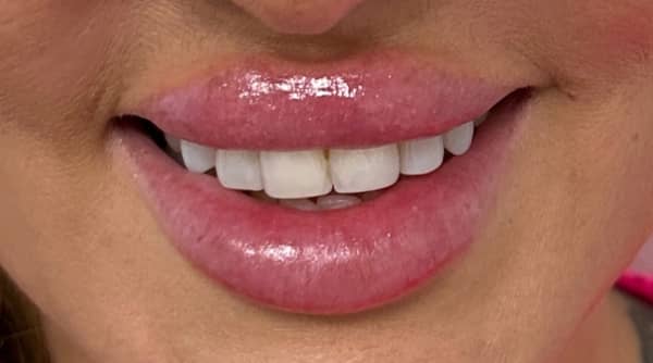 Before - The Beresford Dental Clinic