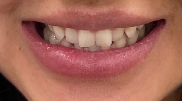 Before - The Beresford Dental Clinic