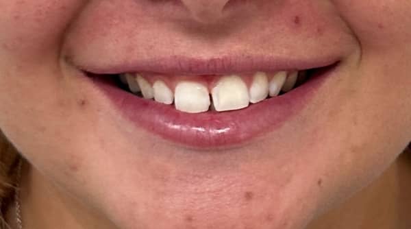 Before - The Beresford Dental Clinic