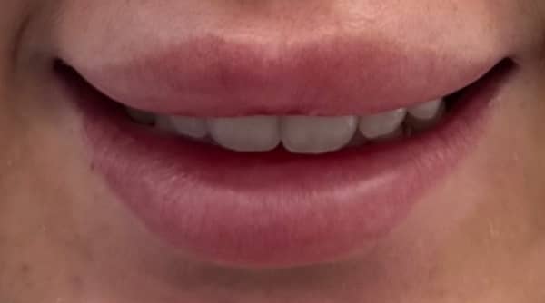 Before - The Beresford Dental Clinic