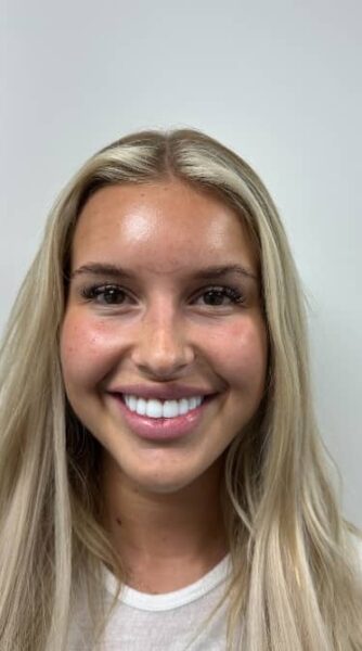 Face After - The Beresford Dental Clinic