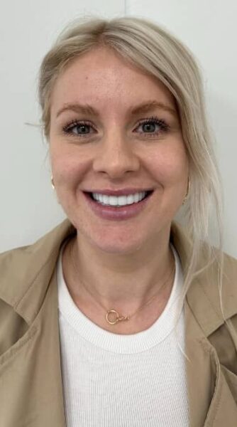 Face After - The Beresford Dental Clinic