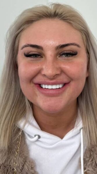 Face After - The Beresford Dental Clinic