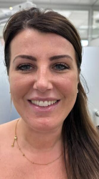 face - The Beresford Dental Clinic