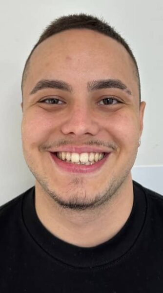 face - The Beresford Dental Clinic