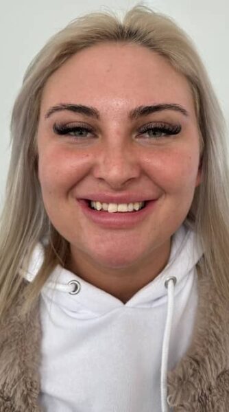 face - The Beresford Dental Clinic