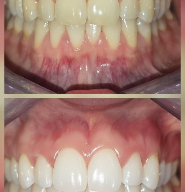 Blog - The Beresford Dental Clinic
