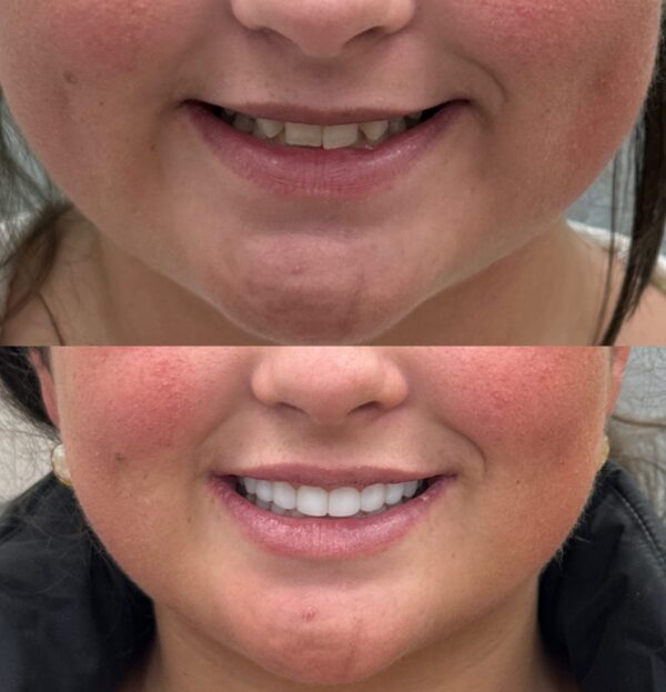 Blog - The Beresford Dental Clinic