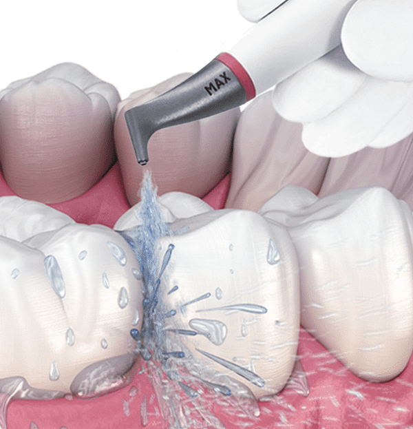 Blog - The Beresford Dental Clinic