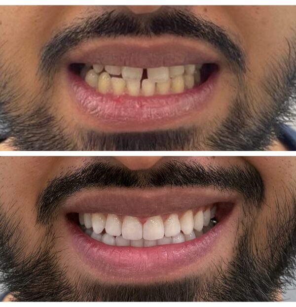 Blog - The Beresford Dental Clinic