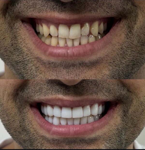 Blog - The Beresford Dental Clinic