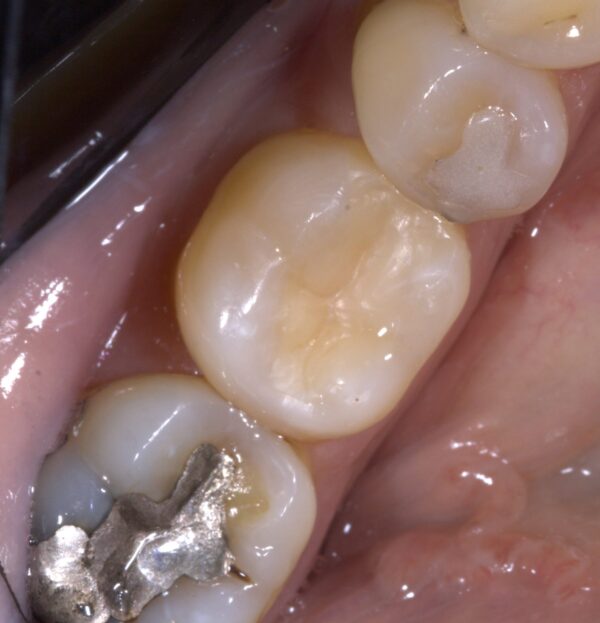 Blog - The Beresford Dental Clinic