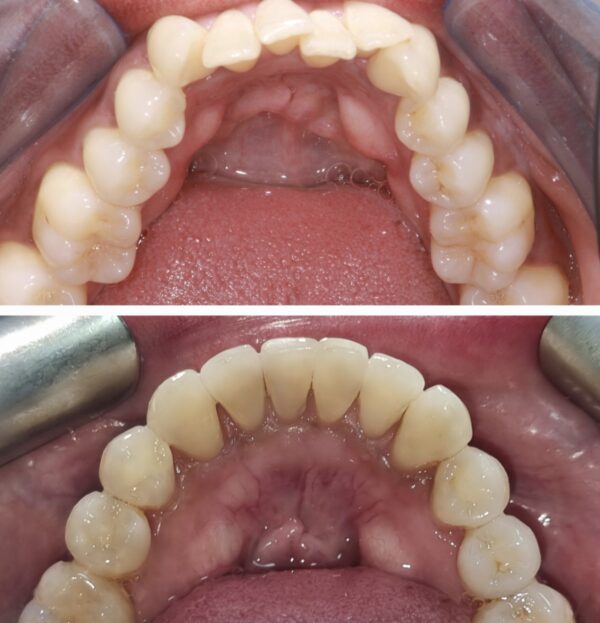 Blog - The Beresford Dental Clinic