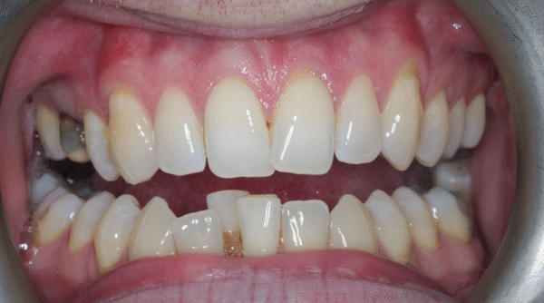 Before - The Beresford Dental Clinic