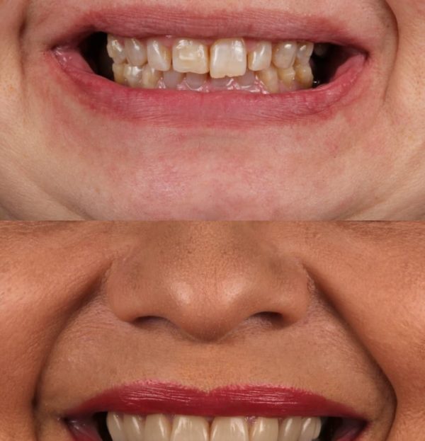 Blog - The Beresford Dental Clinic