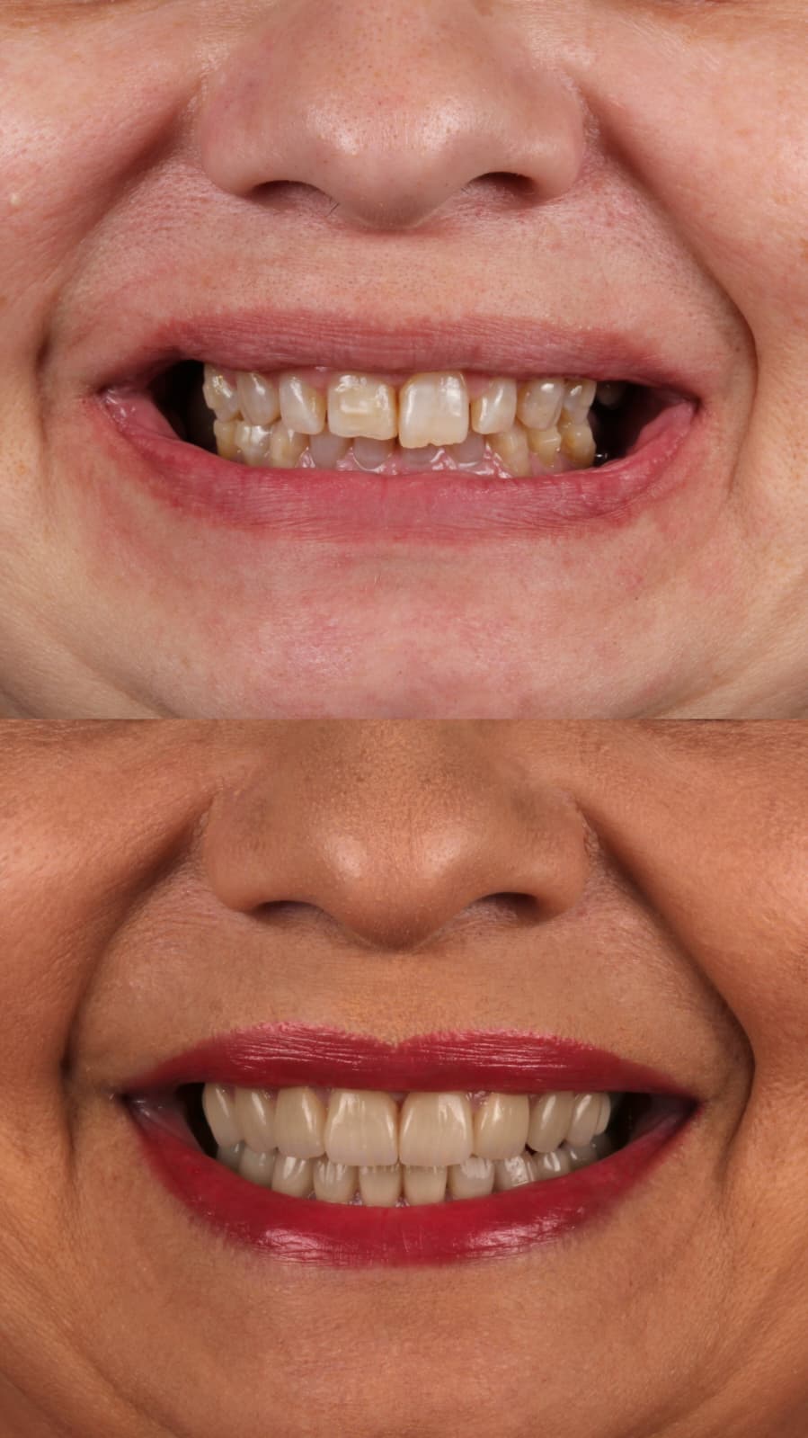 Blog Inner - The Beresford Dental Clinic