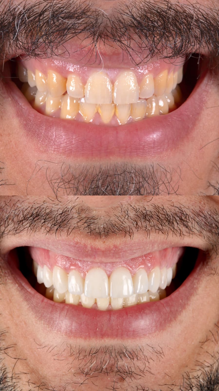 Blog Inner - The Beresford Dental Clinic